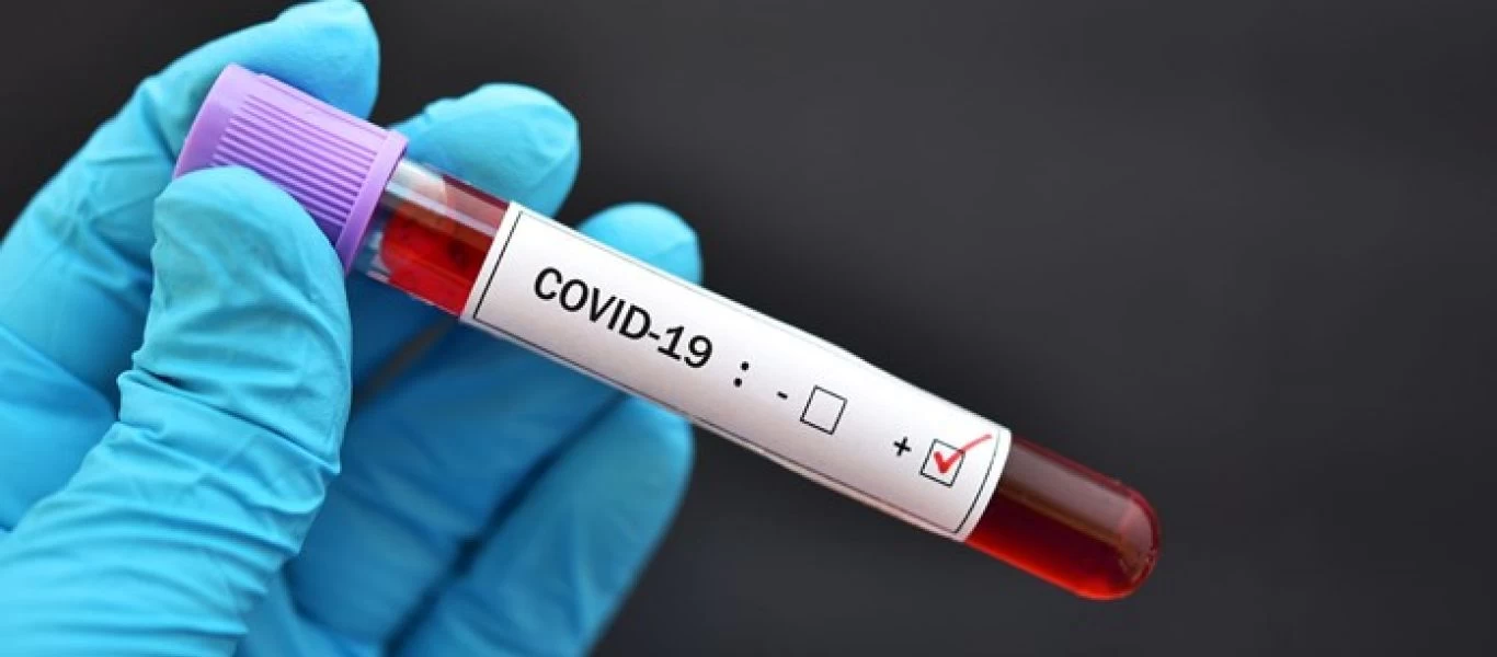 Κορωνοϊός: Επιστήμονες δημιουργούν νέο PCR test που ανιχνεύει τις μεταλλάξεις - Πώς θα λειτουργεί